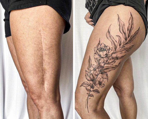 Tattoos Cover Scars (26 pics)