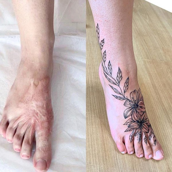 Tattoos Cover Scars (26 pics)