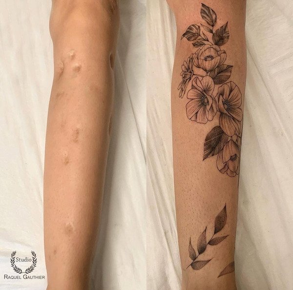 Tattoos Cover Scars (26 pics)