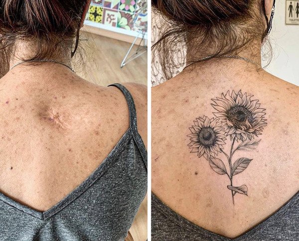 Tattoos Cover Scars (26 pics)