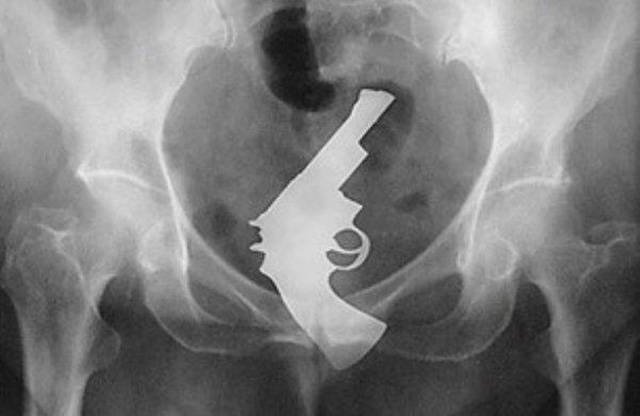 Weird Objects On X-Rays (27 pics)
