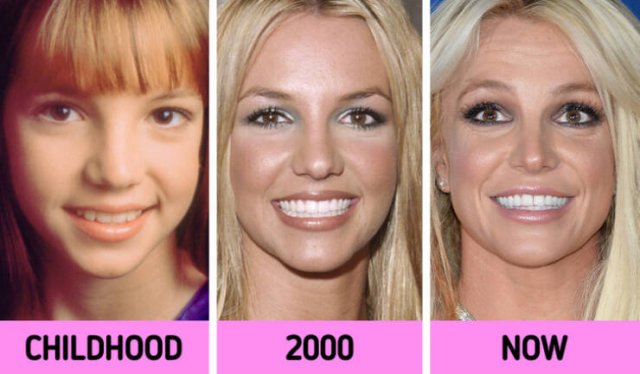 Celebrities Then And Now (11 pics)