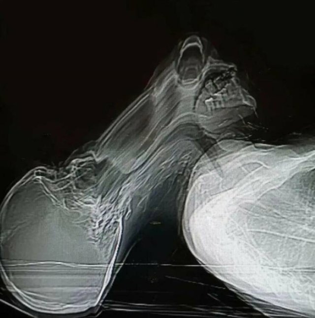 Unusual X-Rays (22 pics)