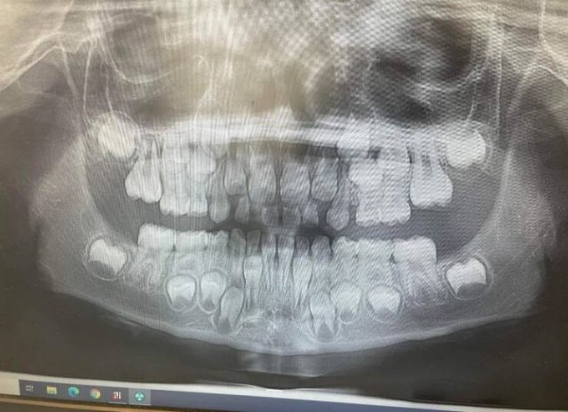Unusual X-Rays (22 pics)