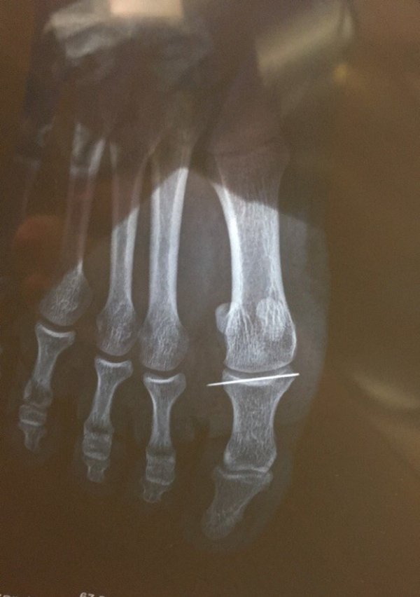 Bad Days Happen (20 pics)
