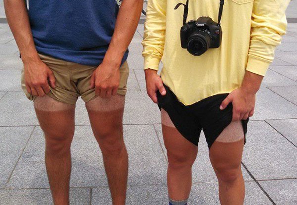 Unusual And Painful Sunburns (28 pics)