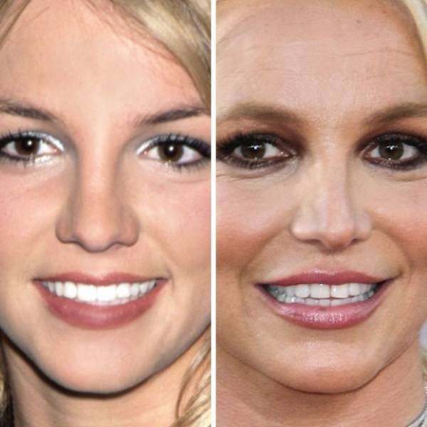 How Celebrities Faces Are Changing (24 pics)