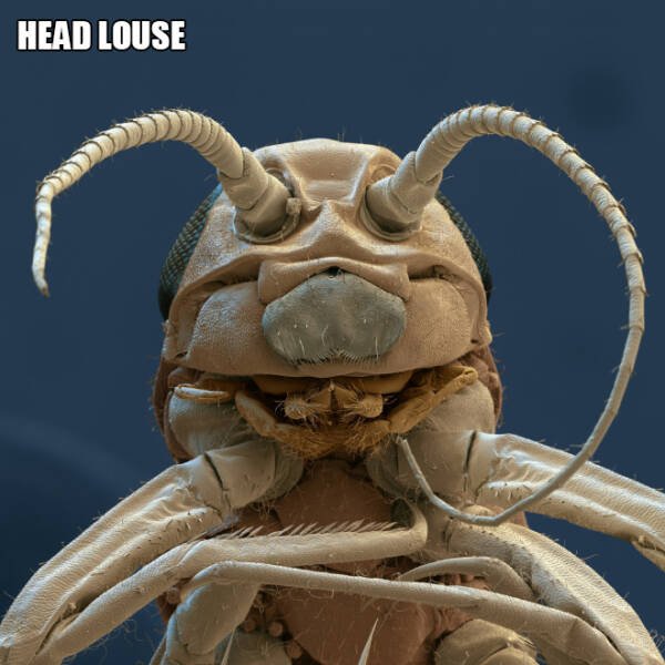 Different Creatures Under The Microscope (18 pics)