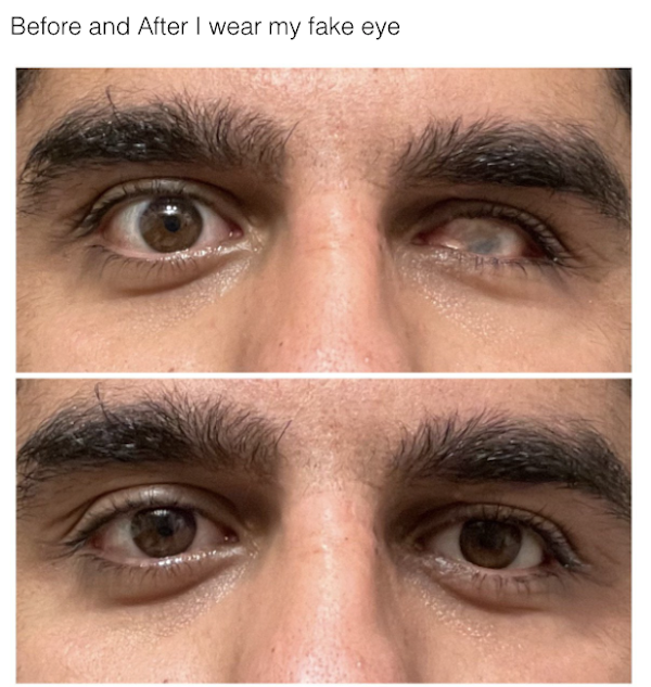 Interesting Before And After Photos (25 pics)