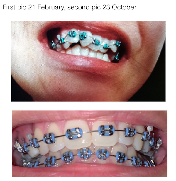 Interesting Before And After Photos (25 pics)