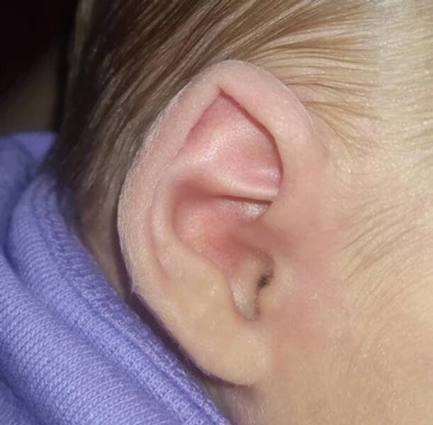 People With Interesting Body Features (18 pics) People With Interesting Body Features (18 pics)