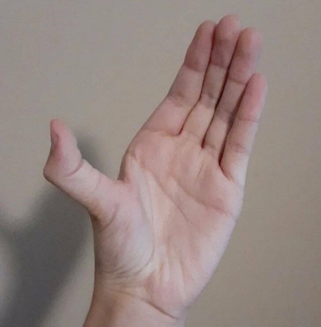 People With Interesting Body Features (18 pics) People With Interesting Body Features (18 pics)