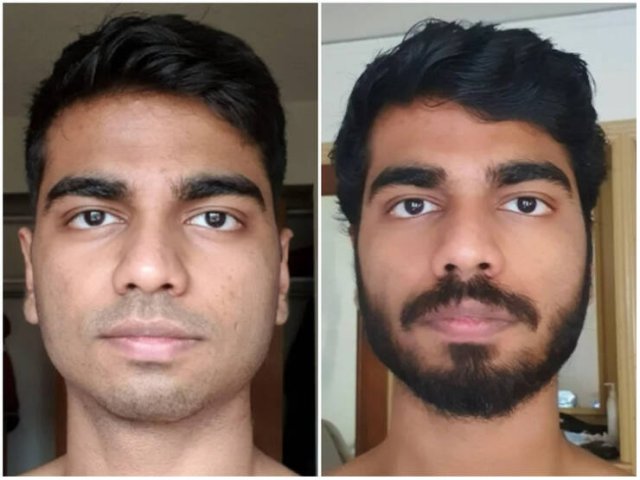 Men With And Without Beard (18 pics)