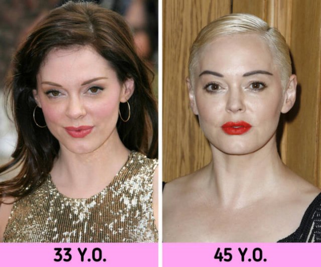 Celebrities Who Have Changed Themselves (15 pics)