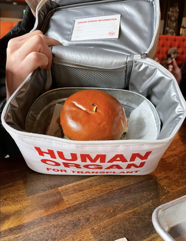 Weird Food Serving (29 pics)