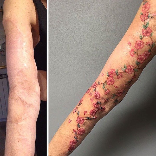 Scars And Tattoos (24 pics)