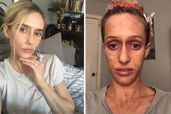 ''Instagram'' Against Reality (30 pics)