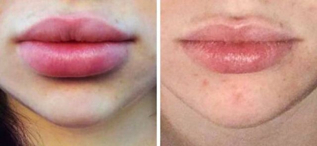 Women Who Forget About Trends (17 pics)
