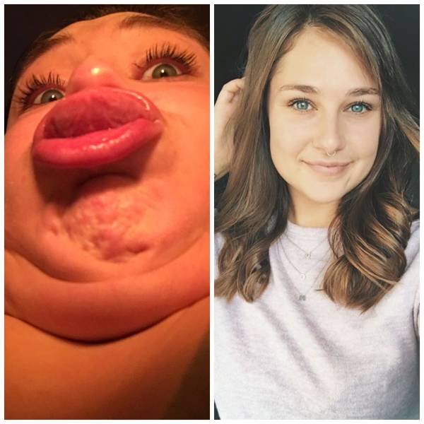 Girls Share Their Funny And Unfortunate Photos (35 pics) Girls Share Their Funny And Unfortunate Photos (35 pics)