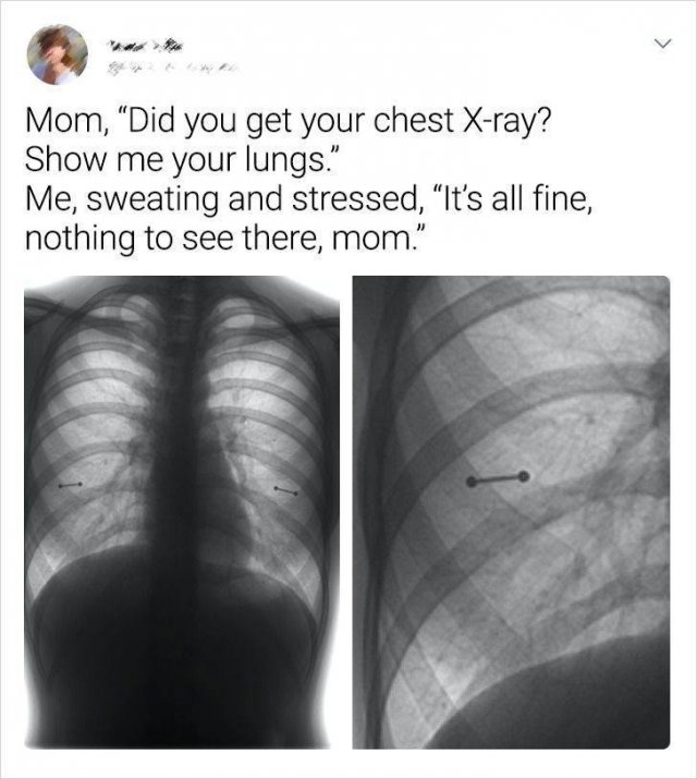 Interesting And Funny X-Rays (15 pics)