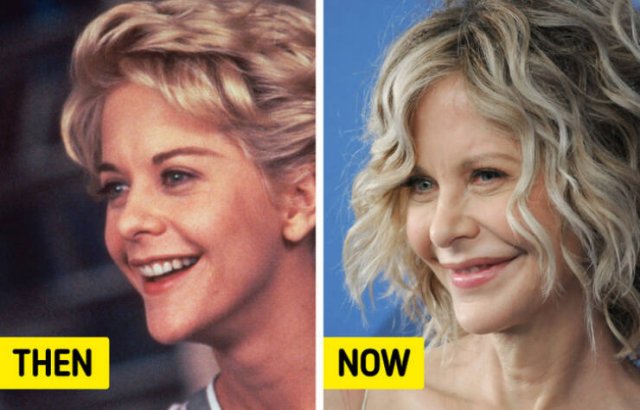 Celebrities Then And Now (15 pics) Celebrities Then And Now (15 pics)