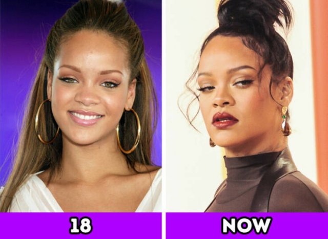 Celebrities At The Age Of 18 And Today (15 pics)