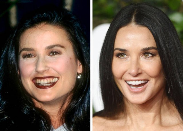 Celebrities Who Changed Their Smiles (19 pics)