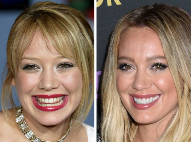 Celebrities Who Changed Their Smiles (19 pics)