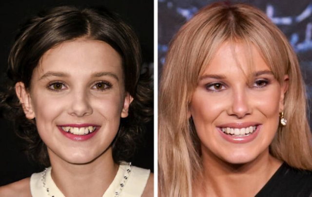 Celebrities Who Changed Their Smiles (19 pics)