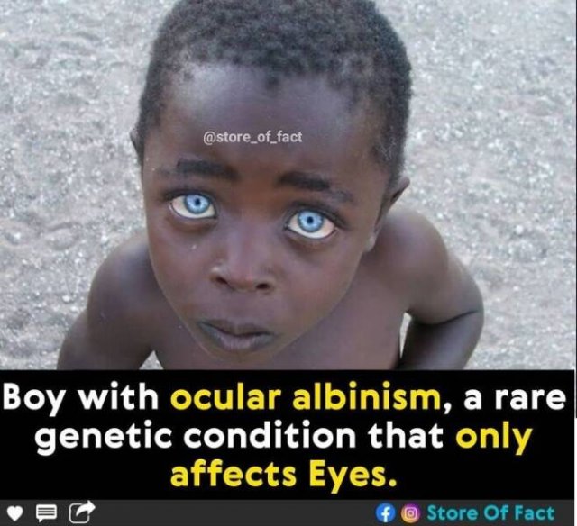 Interesting Facts (44 pics)
