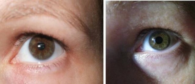 People With Extraordinary Features (17 pics) People With Extraordinary Features (17 pics)