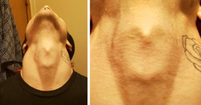 People With Extraordinary Features (17 pics) People With Extraordinary Features (17 pics)