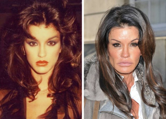 Celebrities Before And After Plastic Surgery (12 pics)