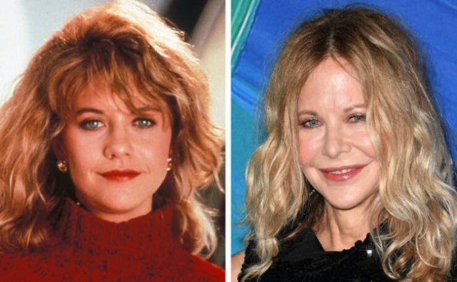 Celebrities Before And After Plastic Surgery (12 pics)