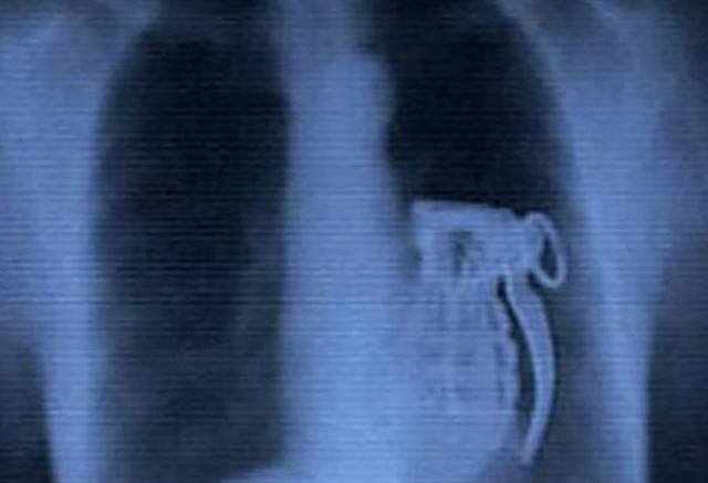 Weird X-Rays (22 pics)
