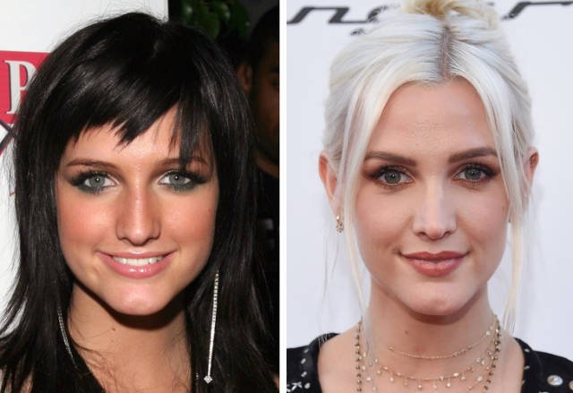Celebrities Before And After Plastic Surgery (10 pics)