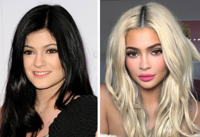 Celebrities Before And After Plastic Surgery (10 pics)