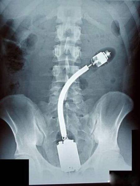 Scary X-Rays (22 pics)