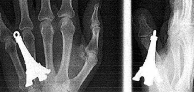 Scary X-Rays (22 pics)