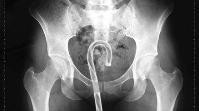 Scary X-Rays (22 pics)