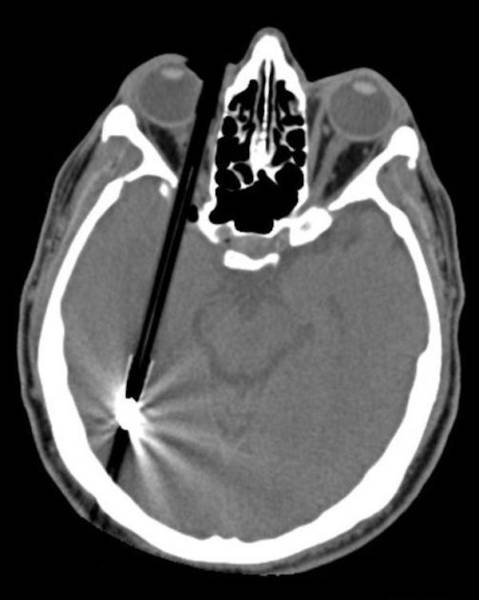 Scary X-Rays (22 pics)