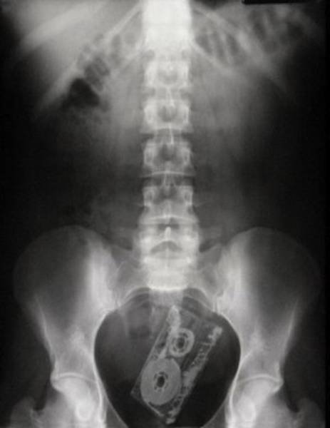 Scary X-Rays (22 pics)