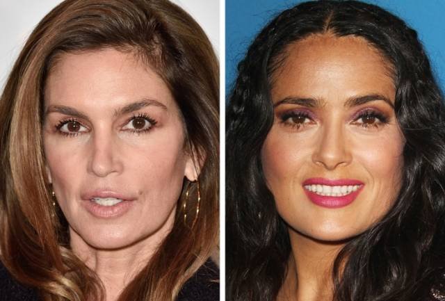 Famous Women After Plastic Surgery (19 pics)