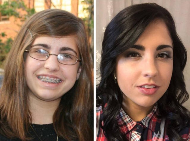 People Who Have Gotten Better Over The Years (20 pics)