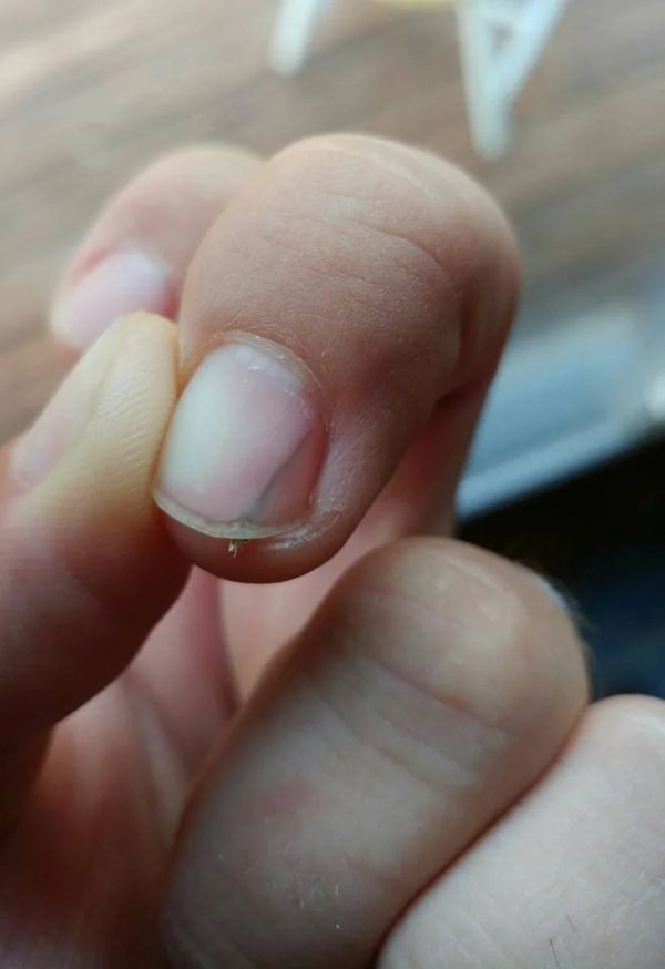Bad Days Happen (18 pics)