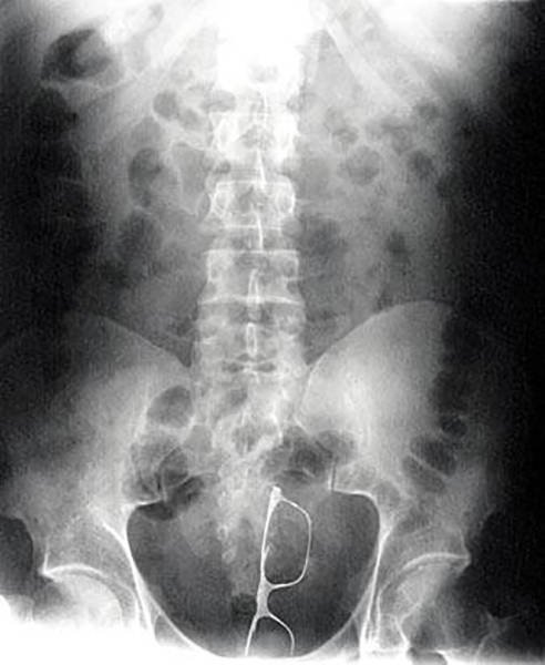 Strange Finds And Situations (40 pics)