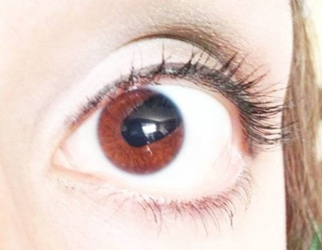 People With Unusual Features (17 pics) People With Unusual Features (17 pics)