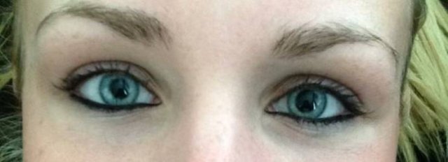 People With Unusual Features (17 pics)