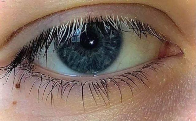 People With Unusual Features (17 pics) People With Unusual Features (17 pics)