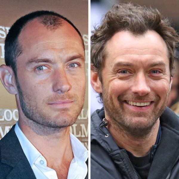 Celebrities With And Without Their Hair (14 pics)